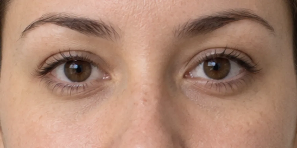 Example: both eyes of a woman seen straight on, with the eye and brow points drawn over them and a line from each inner to outer corner